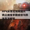 HPV长菜花初期图片揭示病变早期症状与防治方法解析